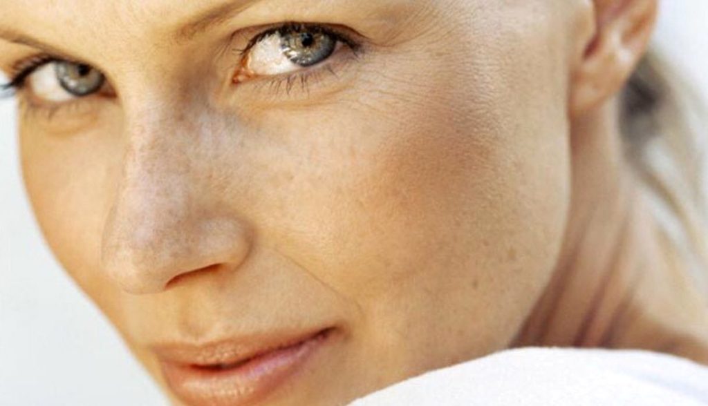 facial-blemishes-how-to-prevent-and-treat-them